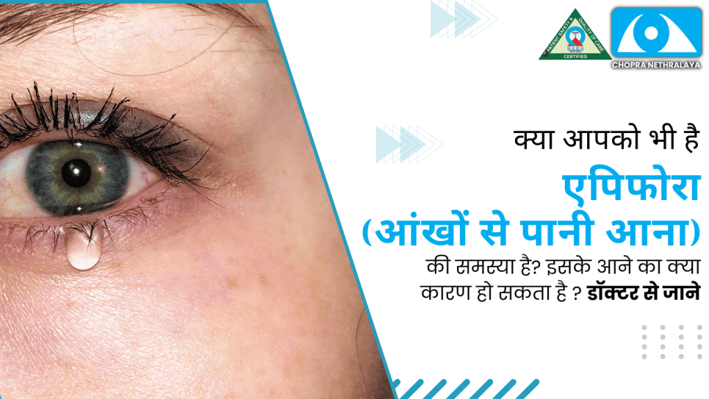 why-do-eyes-water-know-the-causes-of-epiphora-from-a-doctor